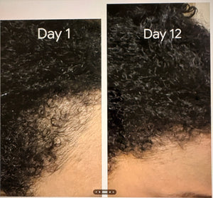 Ultimate Edge Growth Bundle