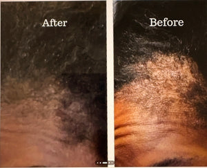 Hair Growth Oil 3.4 oz