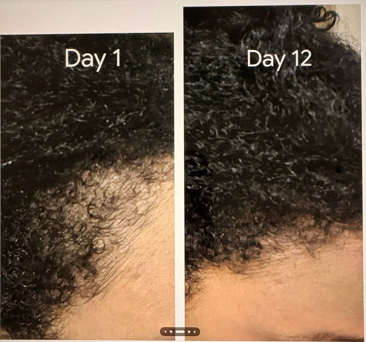 Ultimate Edge Growth Bundle