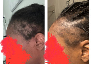 Hair Growth Oil 4 oz